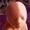 Fetus