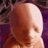 Fetus